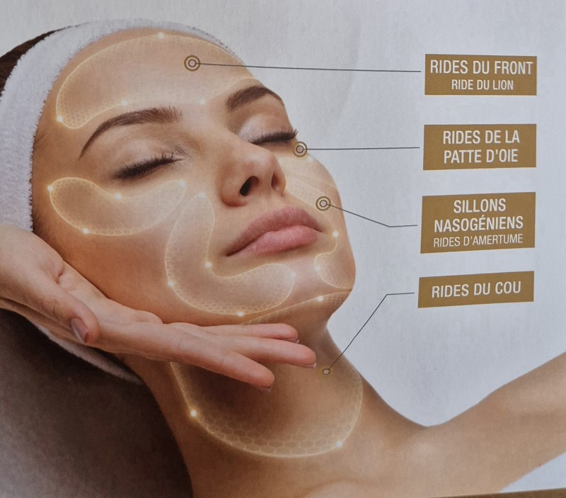 Combien coûte un soin du visage anti-âge à Dijon et comment choisir le bon institut après 50 ans ?